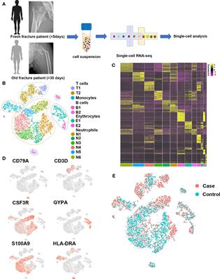 Single-Cell RNA Sequencing Reveals B Cells Are Important Regulators in Fracture Healing